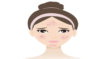 Acne, Arthritis